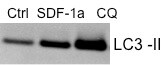 LC3B Antibody [DyLight 550] NB100-2220R